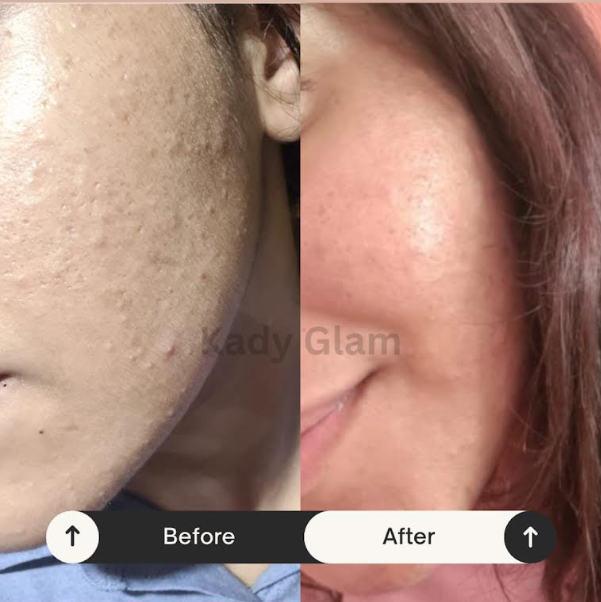 Avant / après client 1