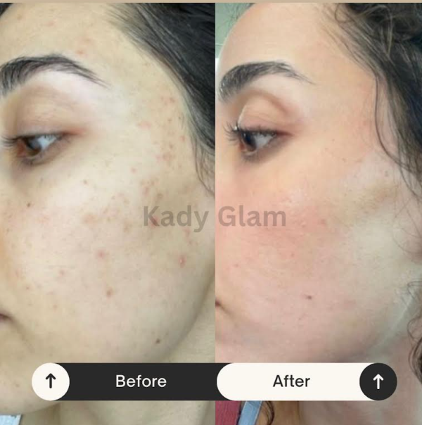 Avant / après client 2