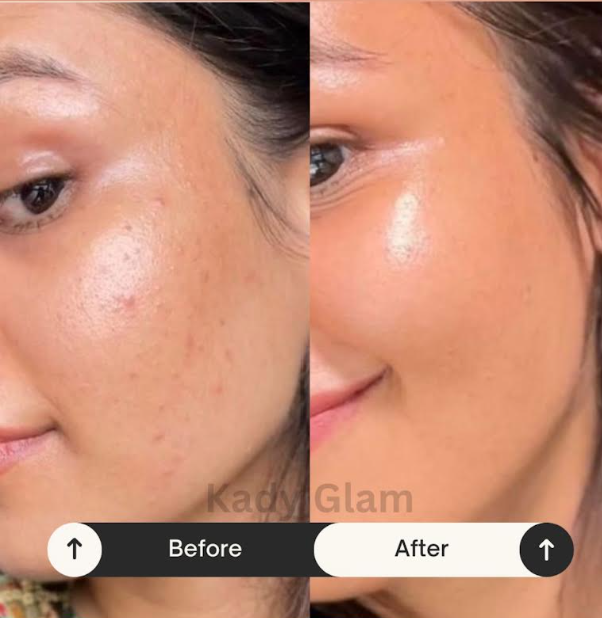 Avant / après client 3